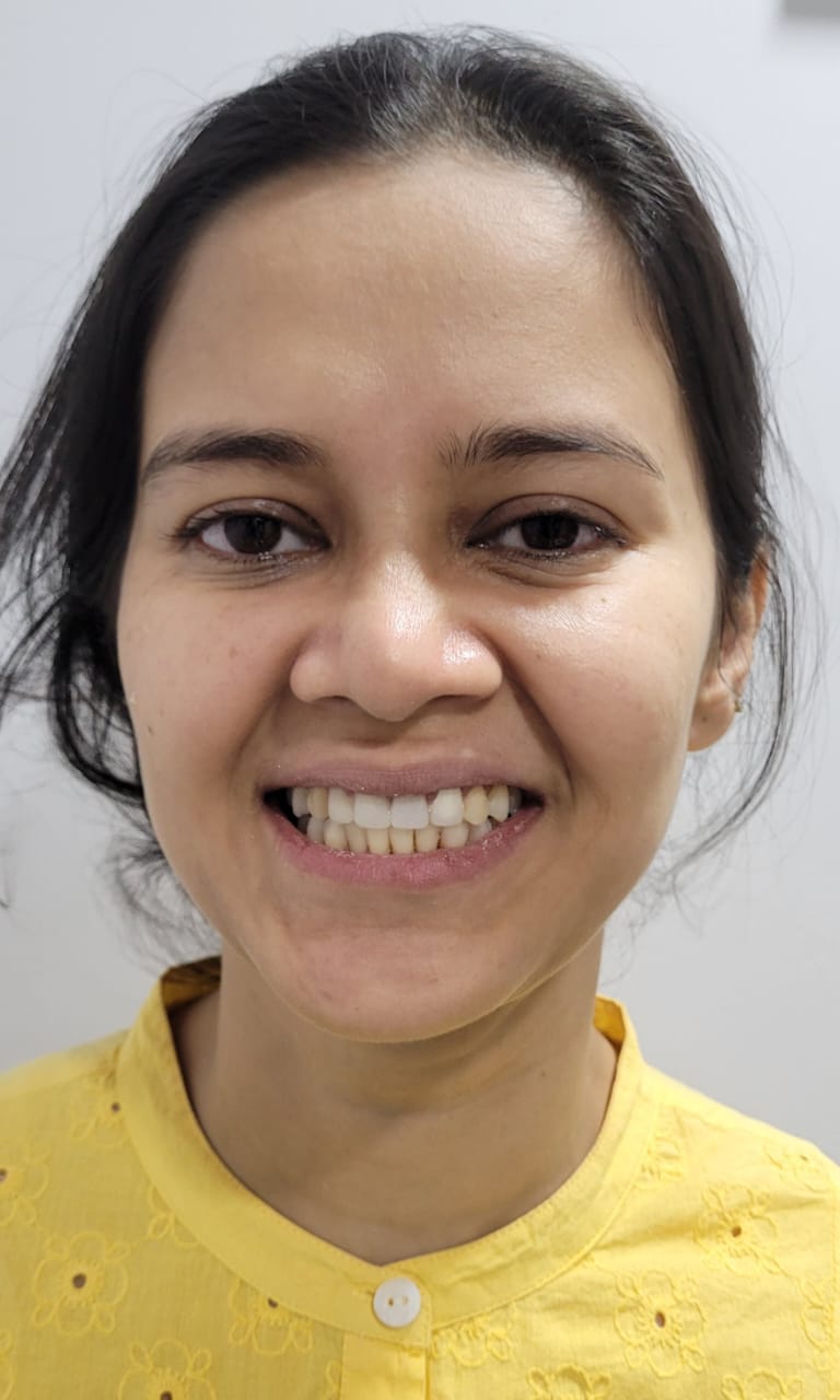 Root canal patient treatment in Kolkata