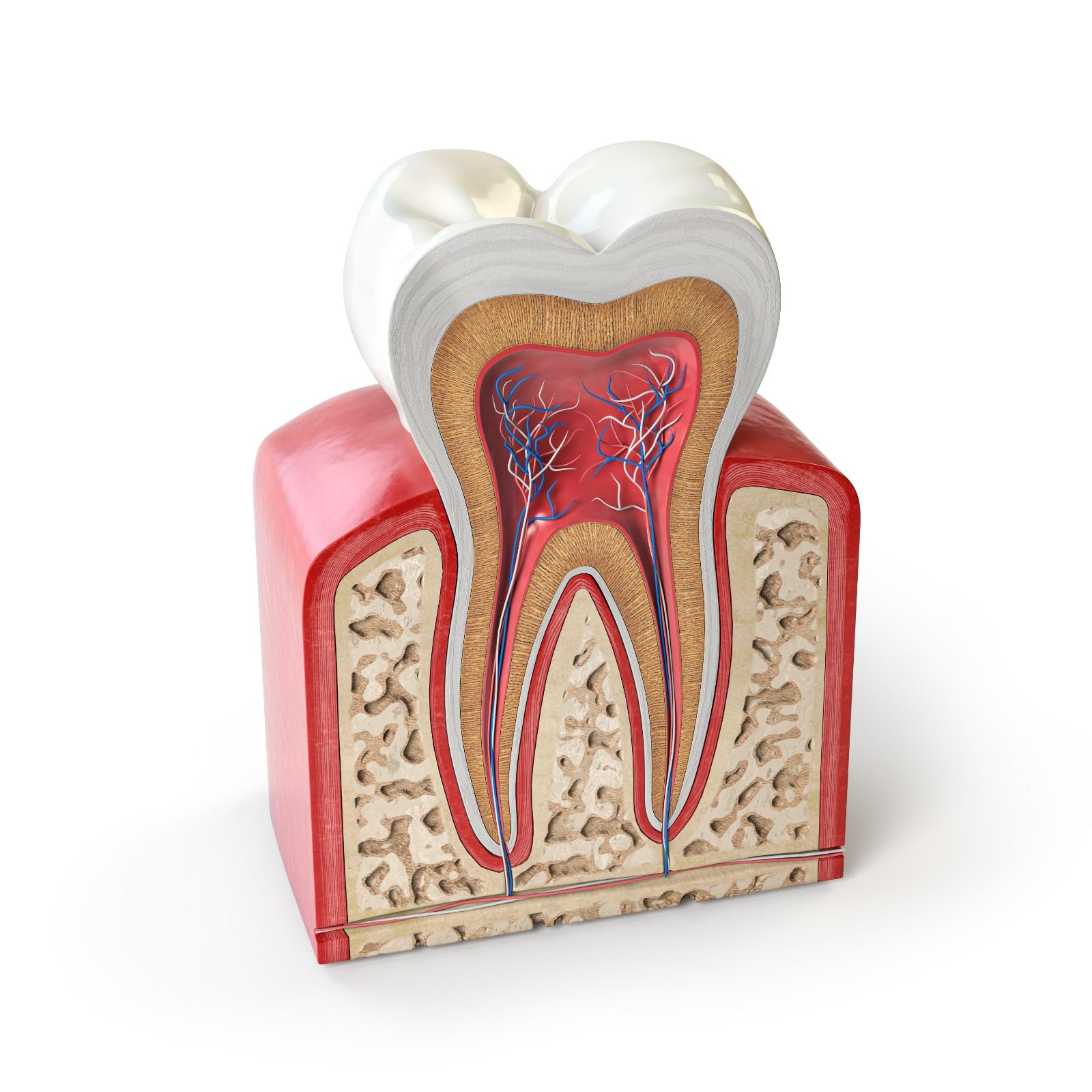 What is root canal treatment (RCT)